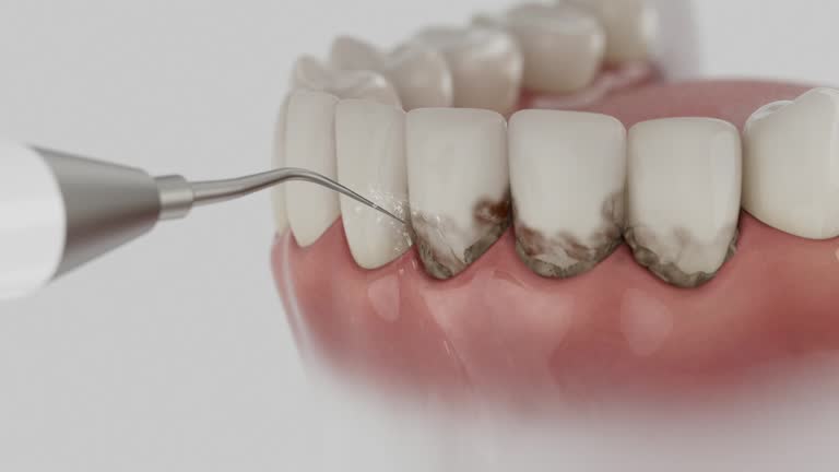 Reliable Dental contractor in Sand Lake, MI by Dentist Open Now
